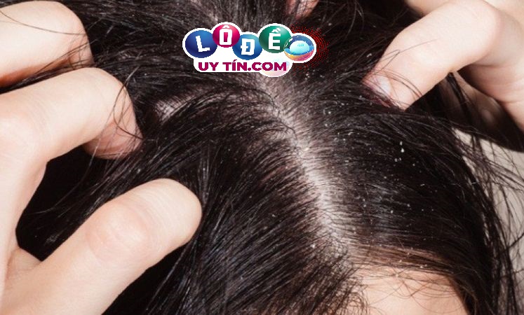 Giải mã giấc mơ: Nằm mơ thấy con chấy đánh con gì dễ ăn?